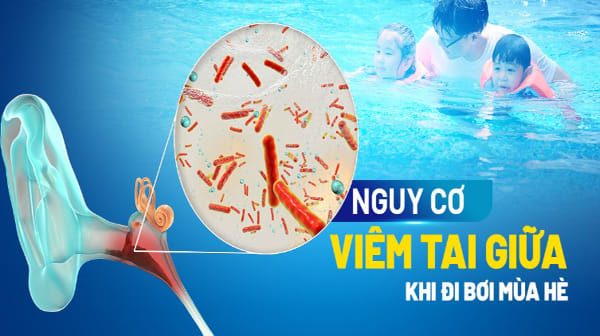 Các yếu tố có thể làm tăng nguy cơ tai của người bơi lội bao gồm